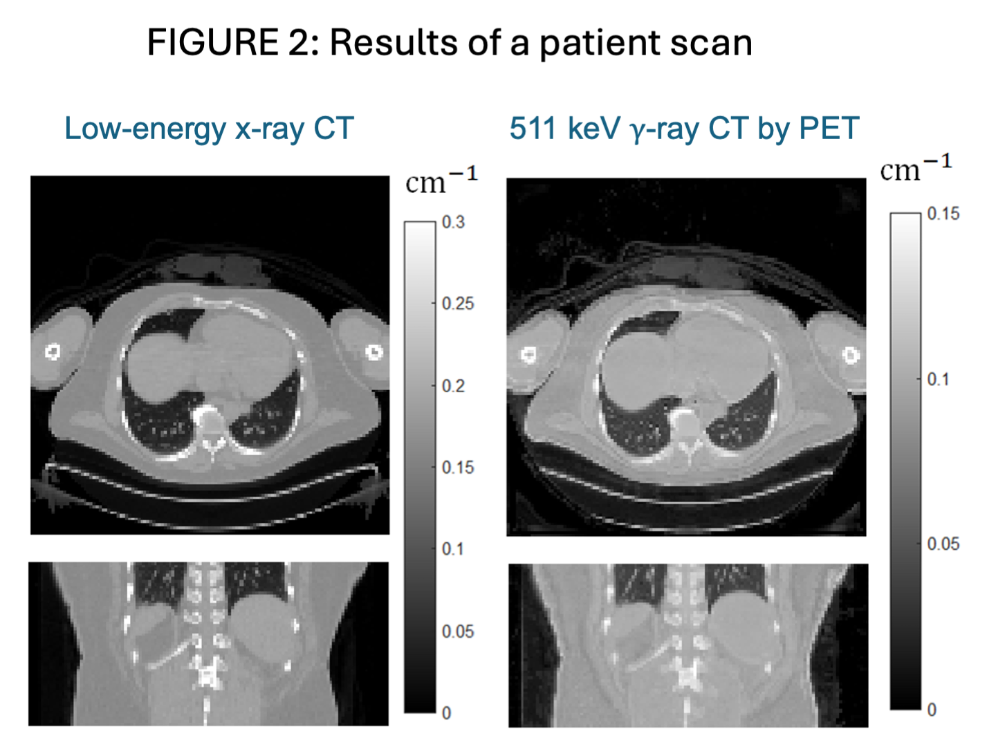 PET-enabled Dual-Energy CT – Wang Lab – PET Parametric Imaging
